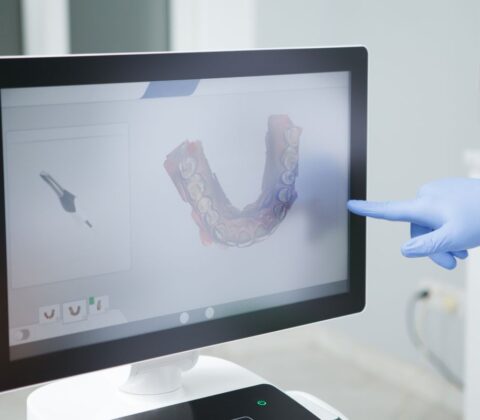 Scanner digitale dentista