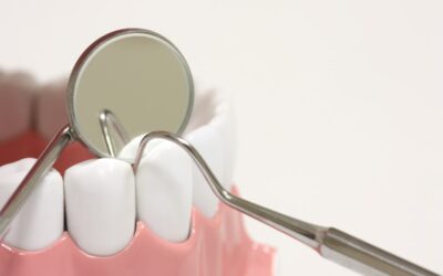Malocclusioni dentali